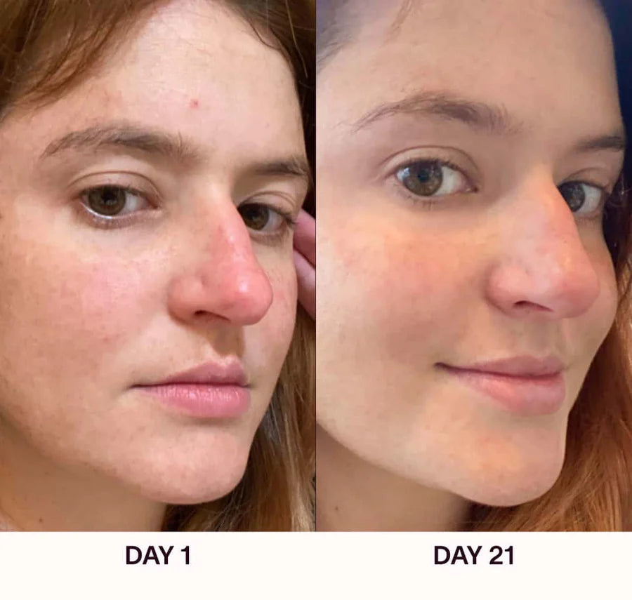 Varita Facial 4 en 1