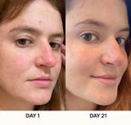 Varita Facial 4 en 1