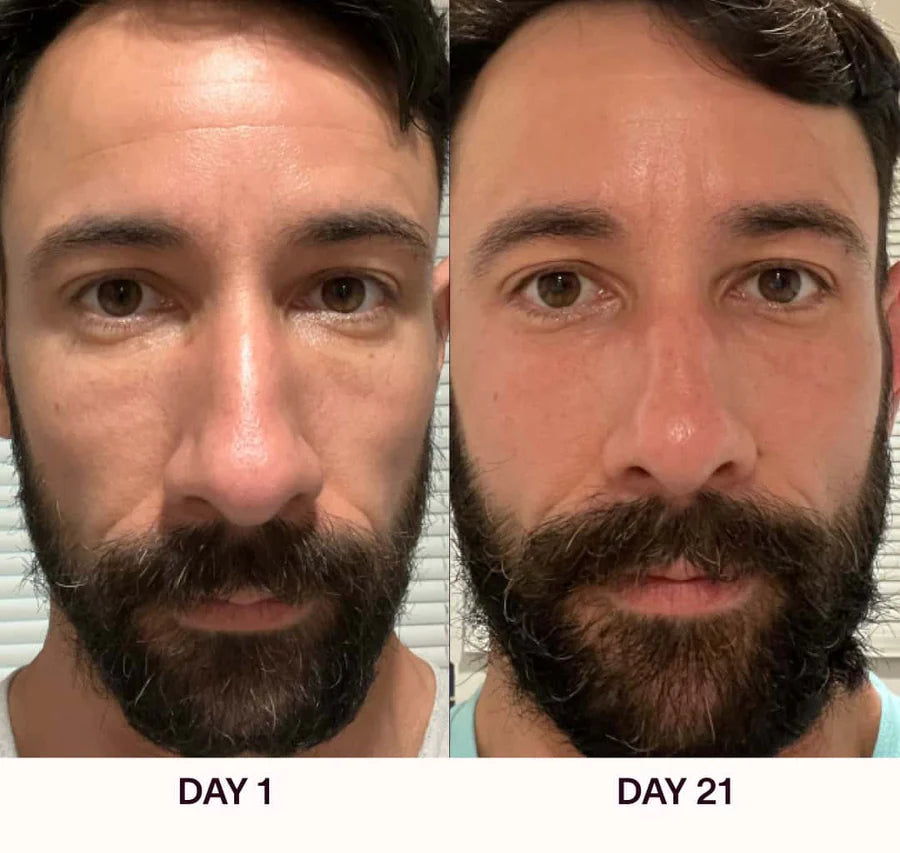 Varita Facial 4 en 1