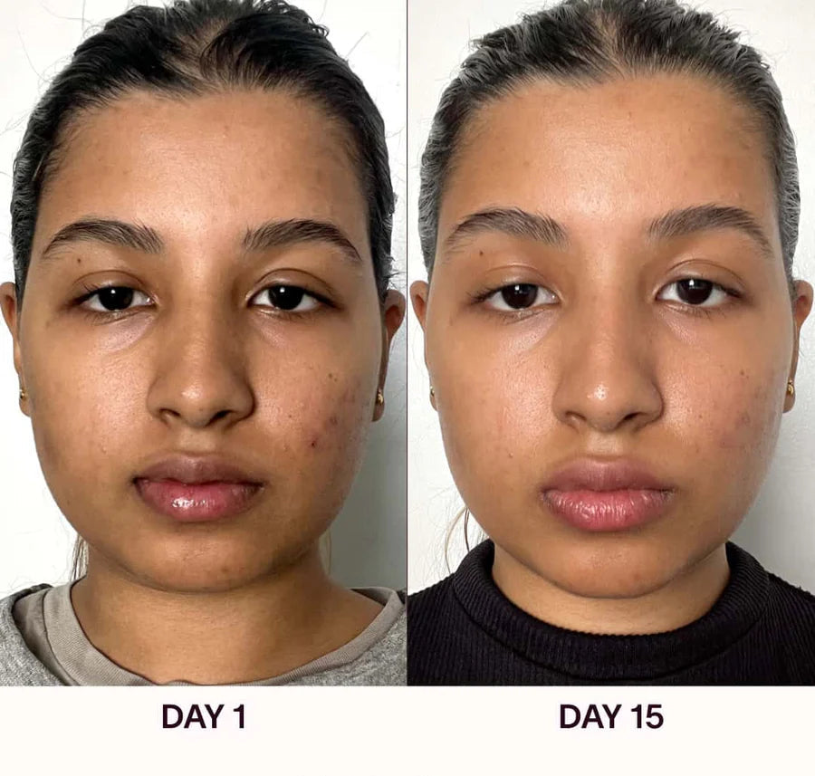 Varita Facial 4 en 1
