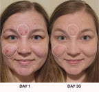 Varita Facial 4 en 1