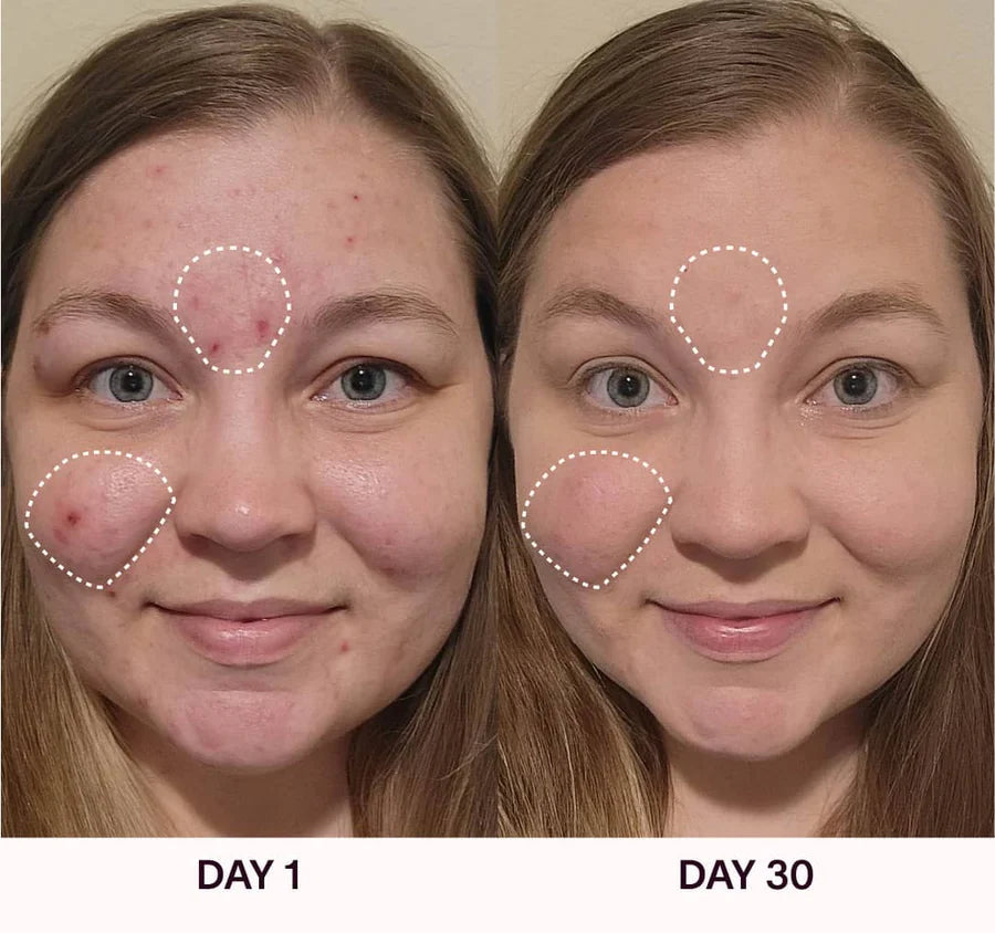 Varita Facial 4 en 1